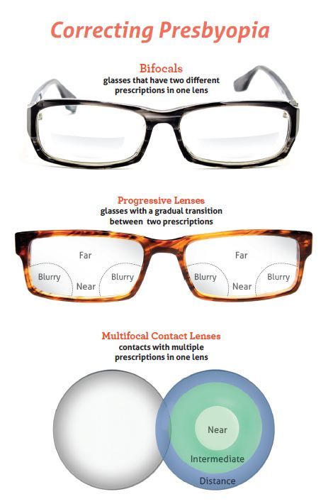 Correcting Presbyopia