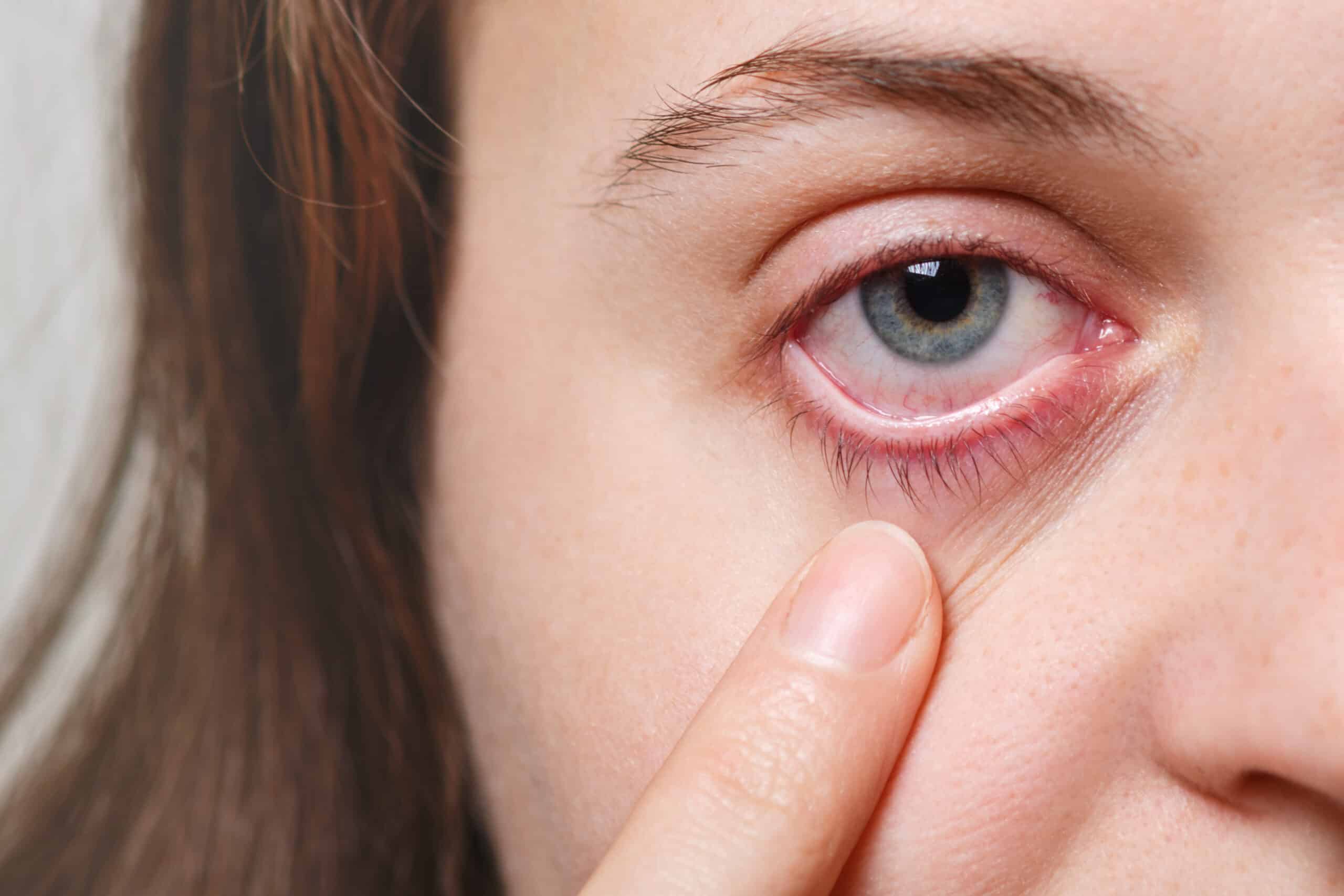 dry eye surgery in thane