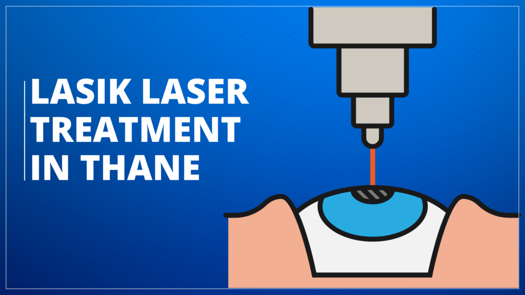 Lasik Laser Treatment in Thane