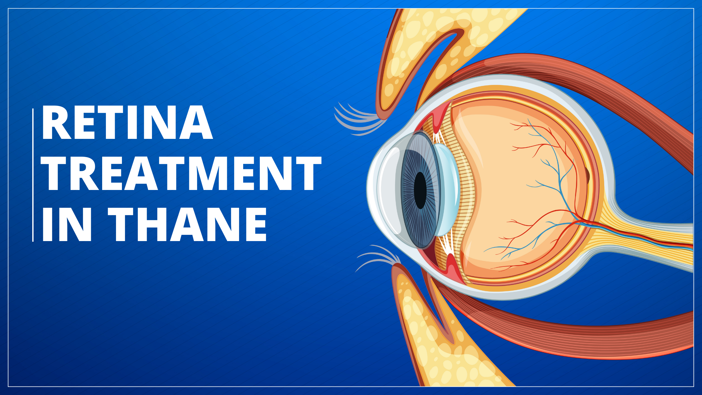 Retina Treatment in thane