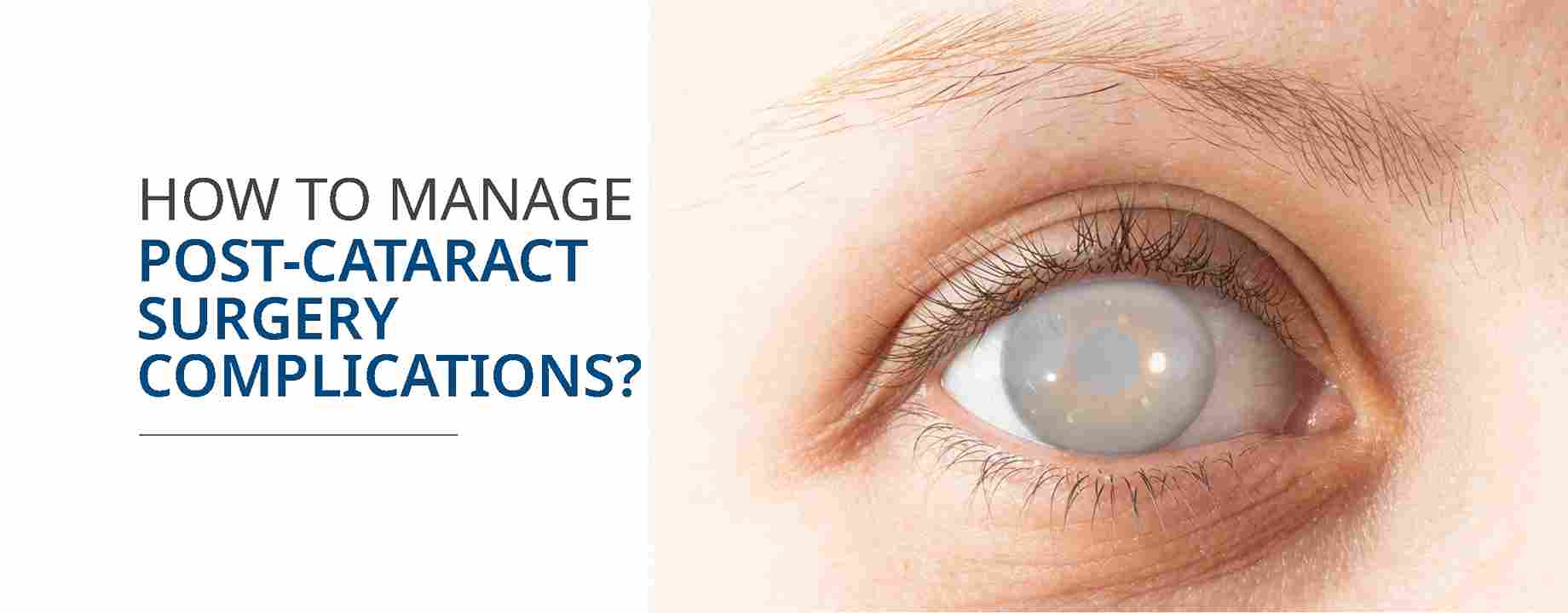Cataract Surgery and Your Vision