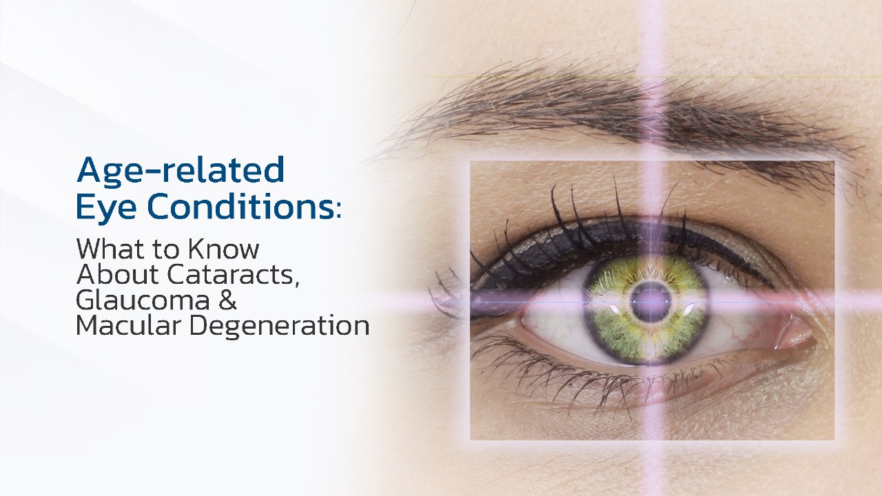 AGE-RELATED EYE CONDITIONS
