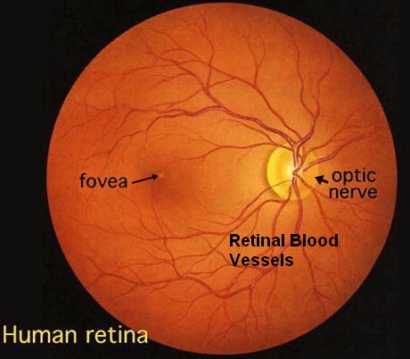 Retina Test
