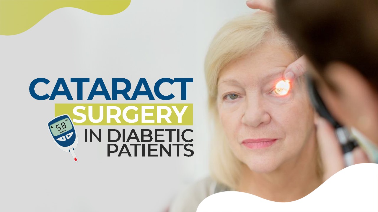 Cataract Surgery in Diabetic Patients