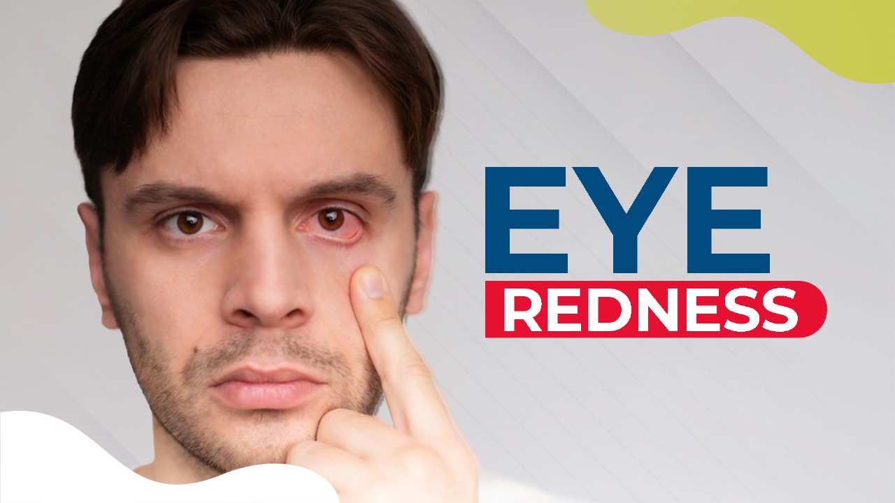 Eye Redness- Consult with Dr Ruchika