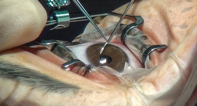 Best ophthalmologist in thane