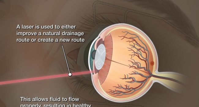 Eye Specialist doctor in Thane